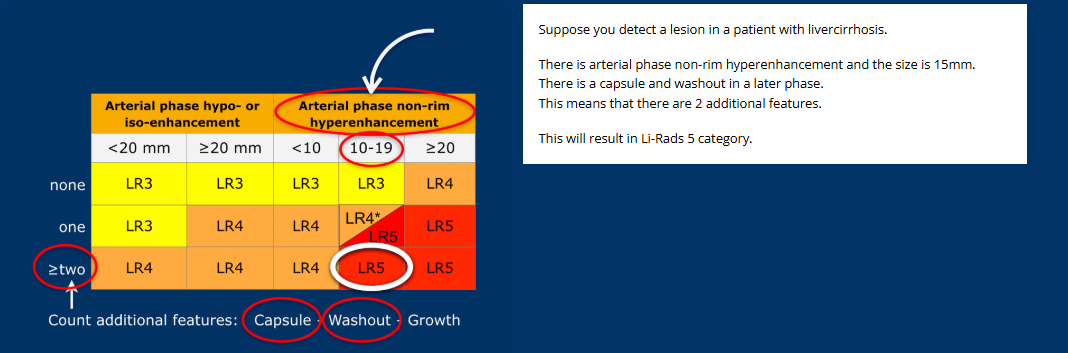 LI-RADS category example