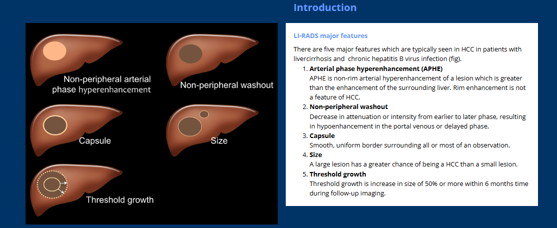 LI-RADS major features
