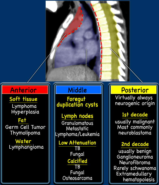 Anterior middle and posterior mediastinal mass differential