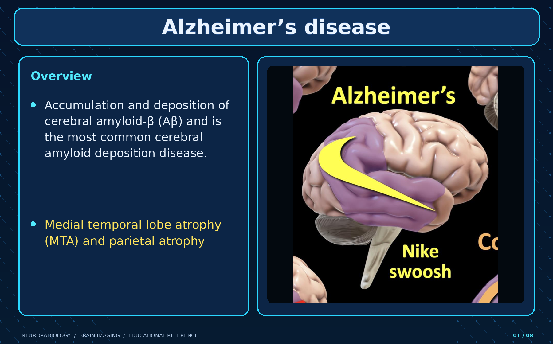 Alzheimer disease overview