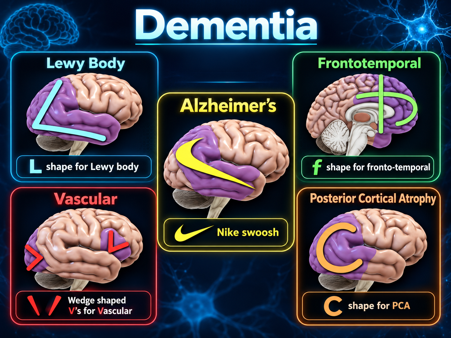 Dementia FDG PET imaging patterns