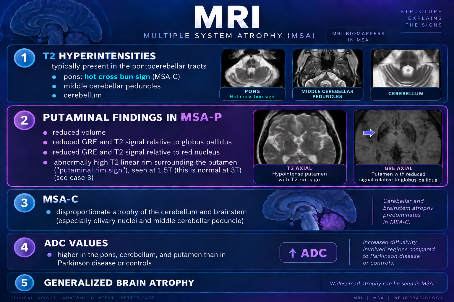 MRI