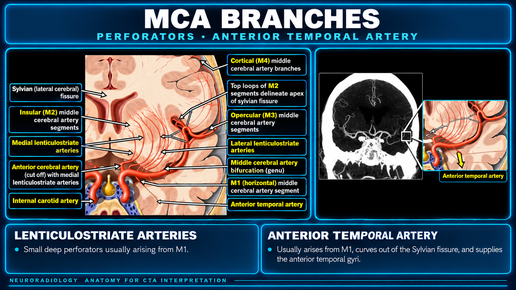 Themed teaching card preserving the labeled branch diagram and CTA example for the lenticulostriate and anterior temporal arteries