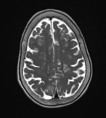 Case 2