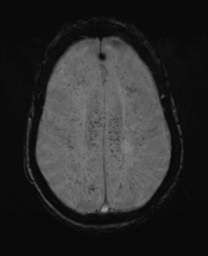 Case 2