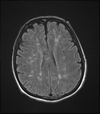 Case 1