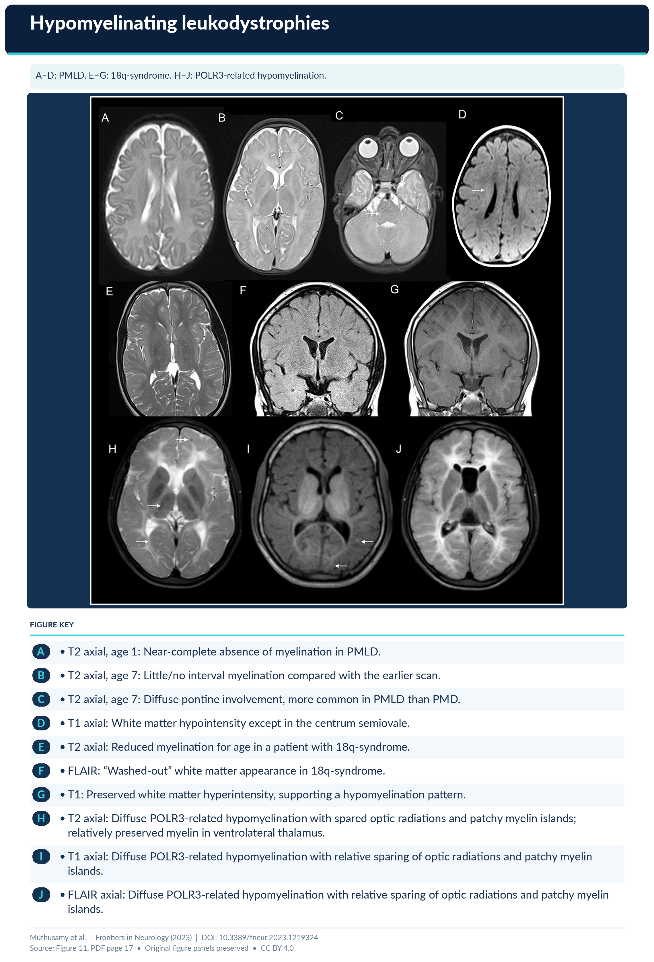 Figure 11 Formatted