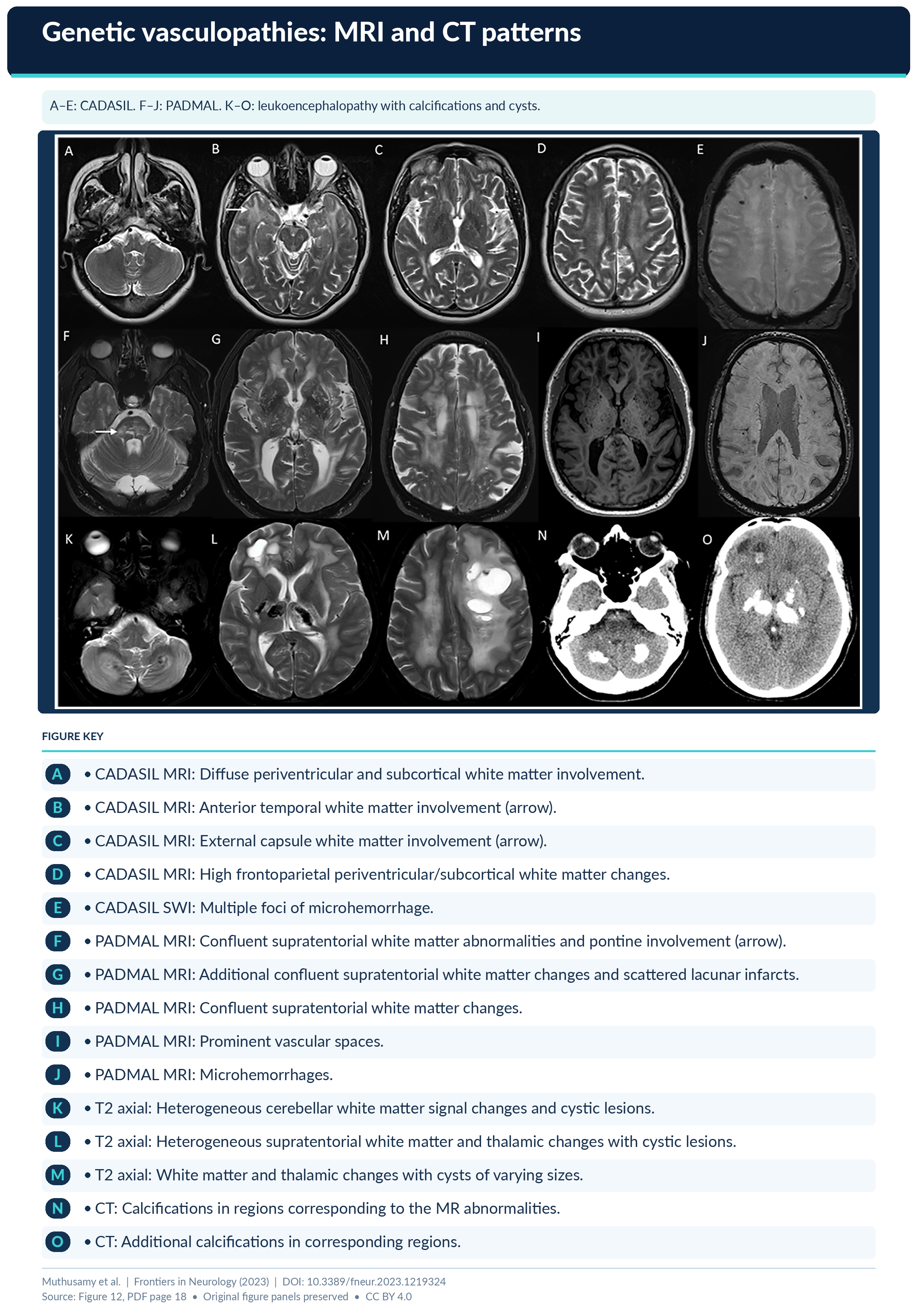 Figure 12 Formatted