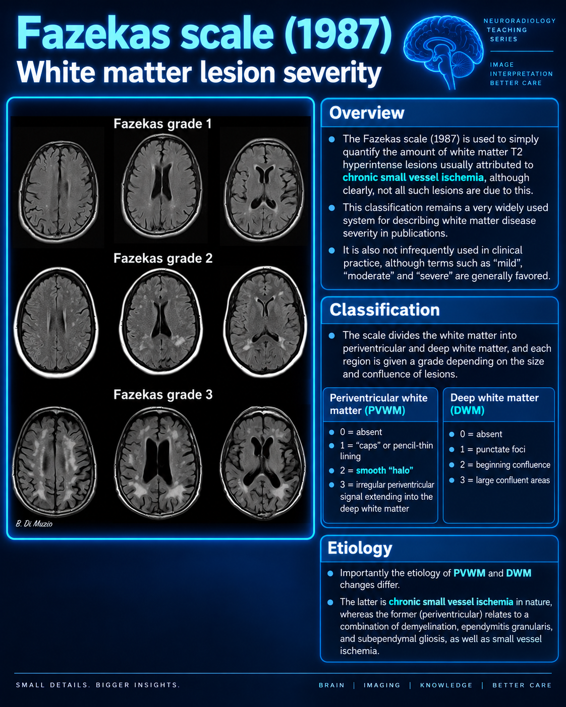 Fazekas scale for white matter lesion severity