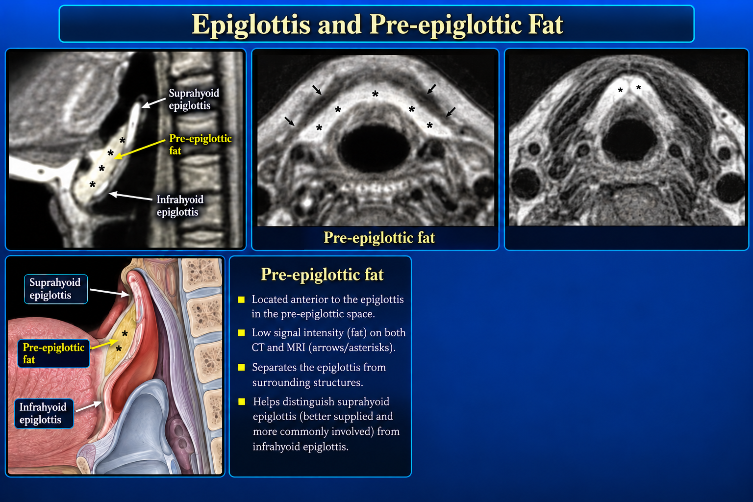 Epiglottis and pre-epiglottic fat on sagittal and axial imaging