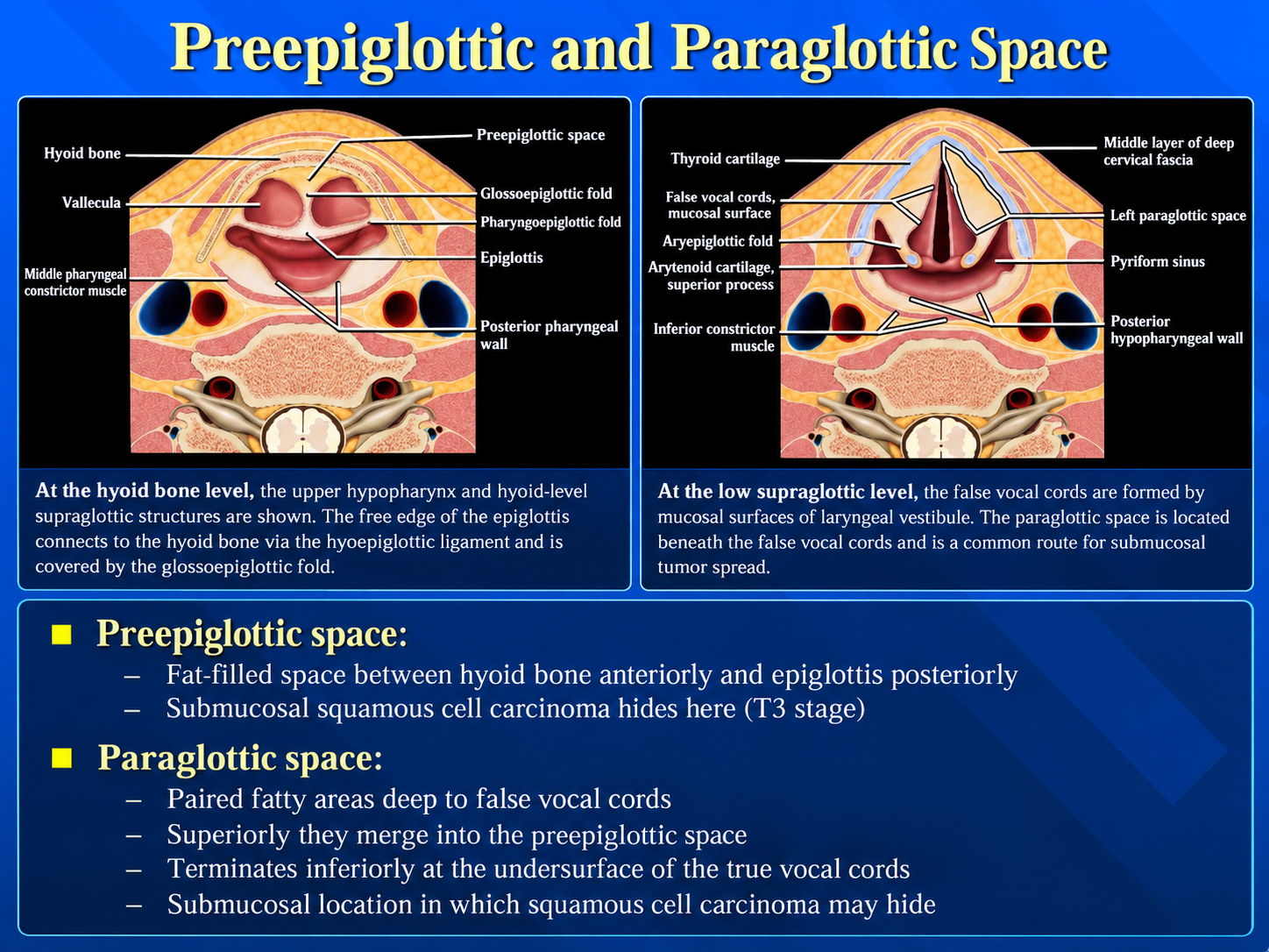 Preepiglottic and paraglottic spaces