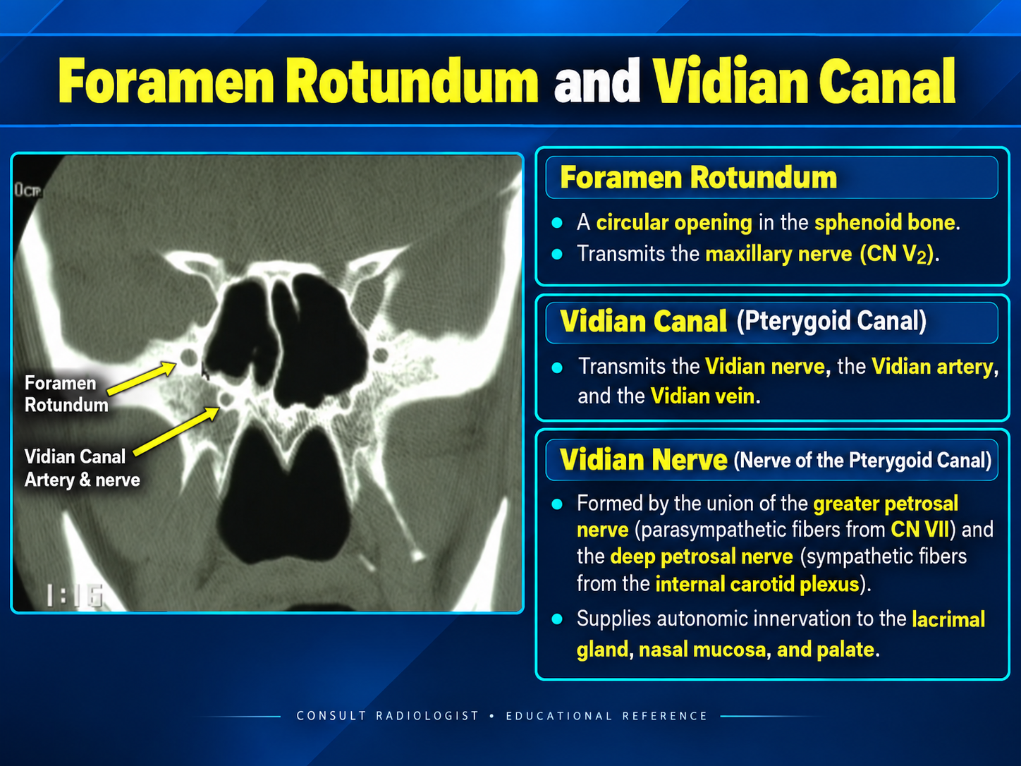 Foramen rotundum and vidian canal anatomy
