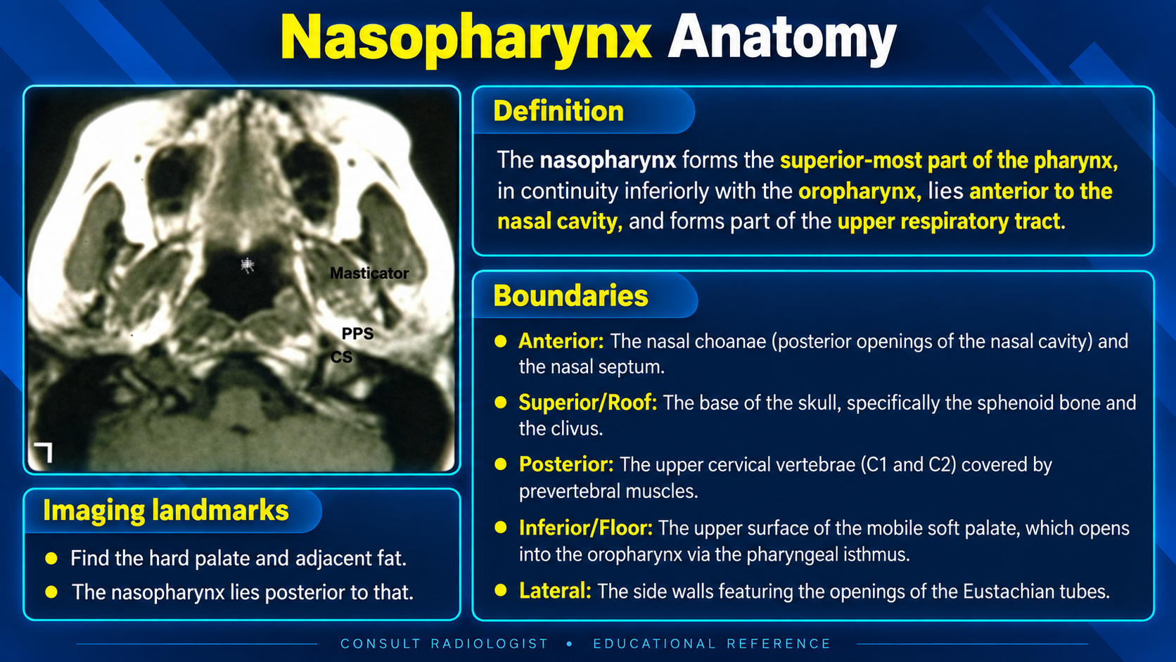 Nasopharynx boundaries and axial imaging landmarks