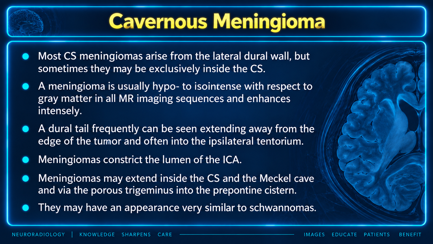 Imaging features of cavernous sinus meningioma