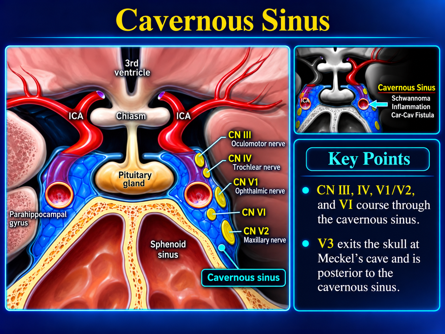 Coronal anatomy of the cavernous sinus and its contents