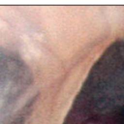 A red shadow is observed extending in the anteroinferior direction from the central portion of the pars tensa.